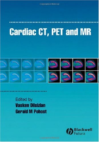 Cardiac CT, PET and MR