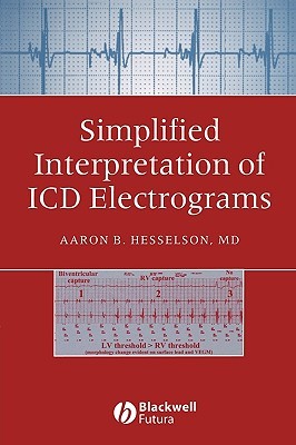 Simplified Interpretation of ICD Electrograms