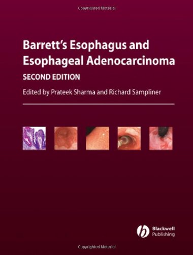 Barrett's Esophagus and Esophageal Adenocarcinoma