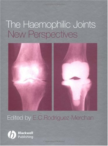 The haemophilic joints : new perspectives