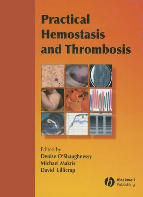 Practical Hemostasis and Thrombosis