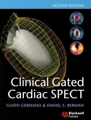 Clinical Gated Cardiac SPECT