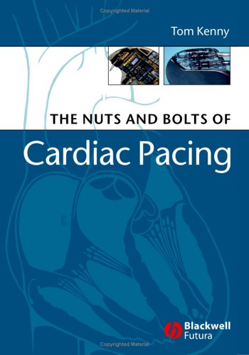 The Nuts and Bolts of Cardiac Pacing