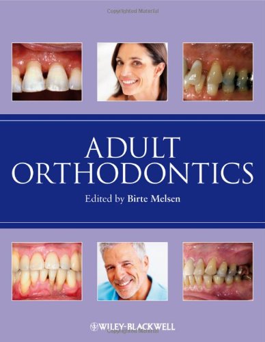 Adult Orthodontics