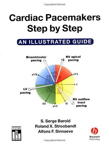 Cardiac Pacemakers Step by Step