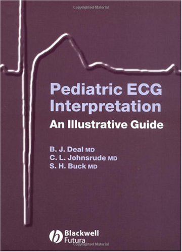 Pediatric ECG Interpretation