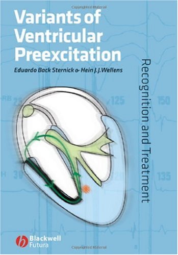 Variants Of Ventricular Preexcitation