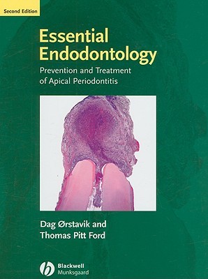 Essential Endodontology