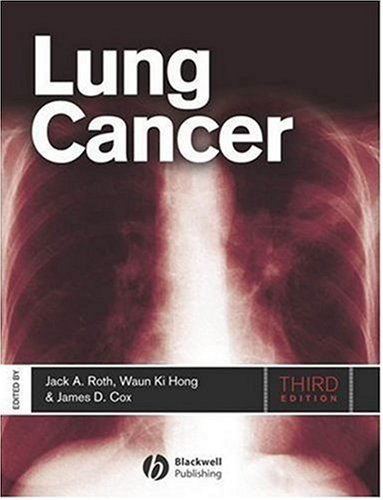 Lung Cancer