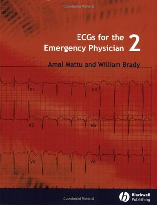 ECGs for the Emergency Physici