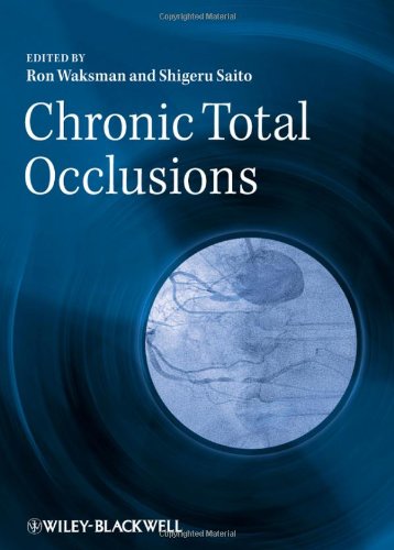 Chronic Total Occlusions