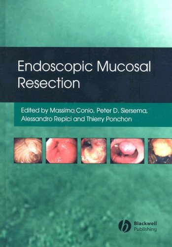 Endoscopic Mucosal Resection