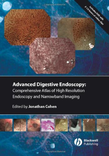 Comprenhensive Atlas of High Resolution Endoscopy and Narrowband Imaging [With DVD-ROM]