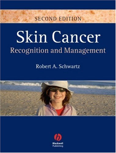 Skin Cancer