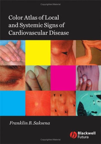 Color Atlas of Local and Systemic Manifestations of Cardiovascular Disease