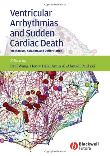 Ventricular Arrhythmias and Sudden Cardiac Death