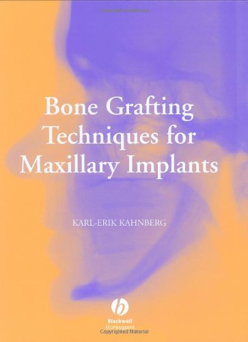 Bone Grafting Techniques for Maxillary Implants