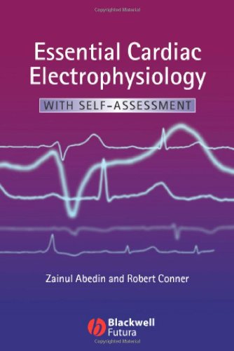 Essential Cardiac Electrophysiology