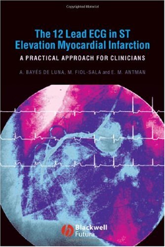 The 12 Lead ECG in St Elevation Myocardial Infarction