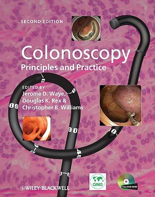 Colonoscopy