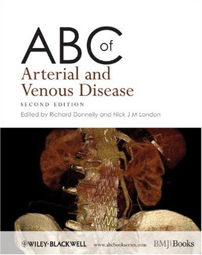 ABC of Arterial and Venous Disease