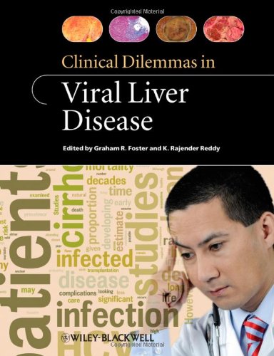 Clinical Dilemmas In Viral Liver Disease