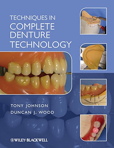 Techniques in Complete Denture