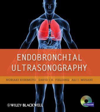 Endobronchial Ultrasonography