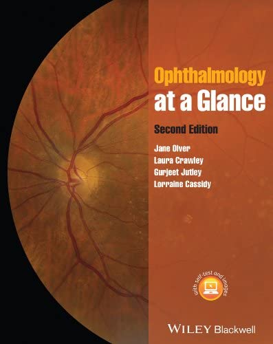 Ophthalmology at a Glance