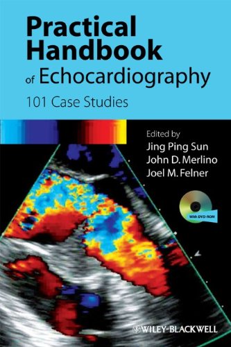 Practical Handbook of Echocardiography