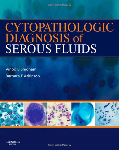 Cytopathologic Diagnosis of Serous Fluids