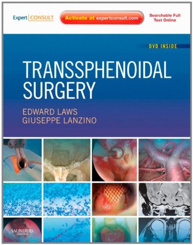 Transsphenoidal Surgery: Expert Consult - Online and Print