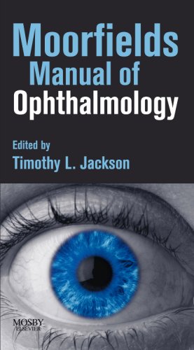 Moorfields Manual of Ophthalmology