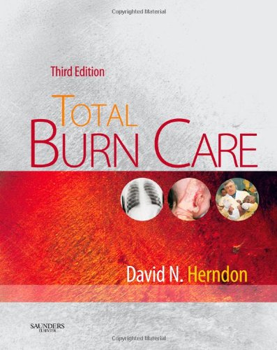 Total Burn Care