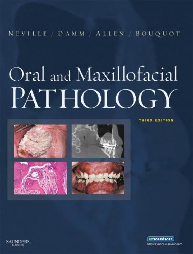 Oral and Maxillofacial Pathology, 3rd Edition