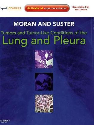 Tumors and Tumor-like Conditions of the Lung and Pleura: Expert Consult: Online and Print