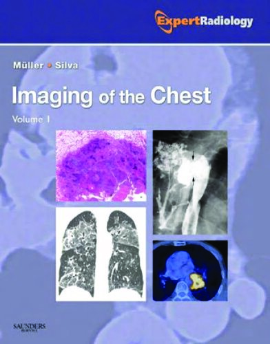 Imaging of the Chest, 2-Volume Set