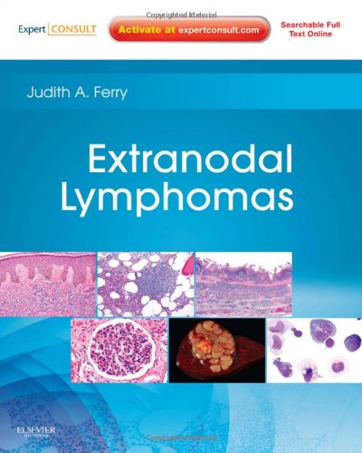 Extranodal Lymphomas