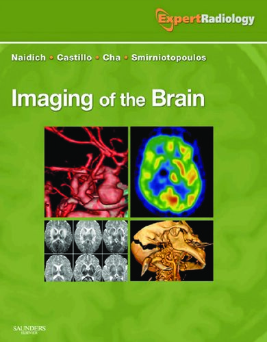 Imaging of the Brain