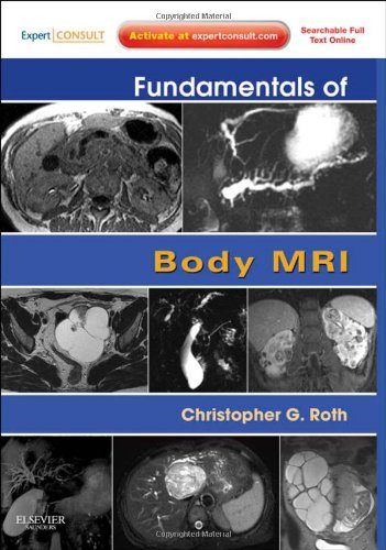 Fundamentals of Body MRI