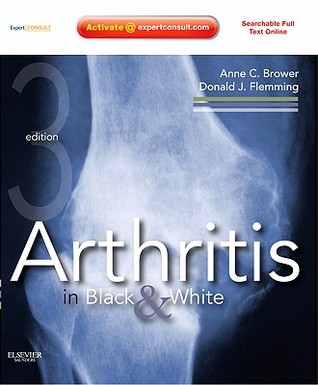 Arthritis In Black And White