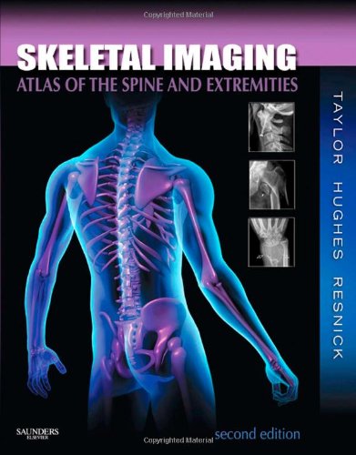 Skeletal Imaging