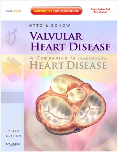 Valvular Heart Disease: A Companion to Braunwald's Heart Disease: Expert Consult - Online and Print