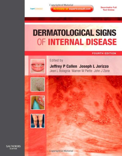 Dermatological Signs of Internal Disease