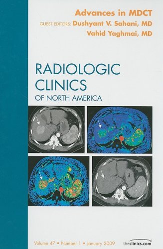 Advances in Mdct, an Issue of Radiologic Clinics, 47