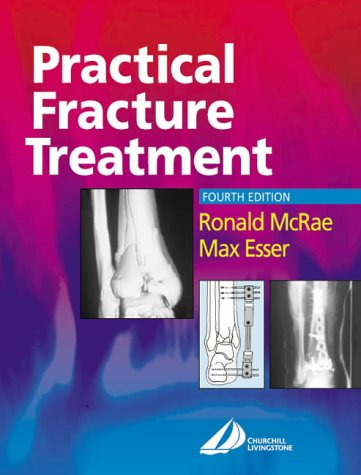 Practical fracture treatment