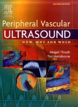 Peripheral vascular ultrasound : how, why, and when