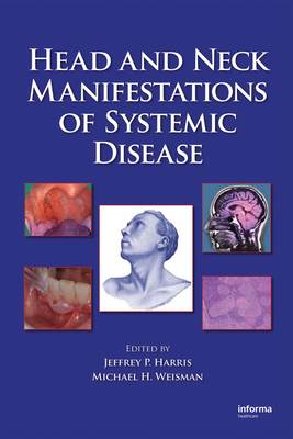 Head and Neck Manifestations of Systemic Disease