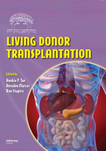 Living Donor Transplantation