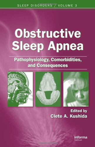 Obstructive Sleep Apnea